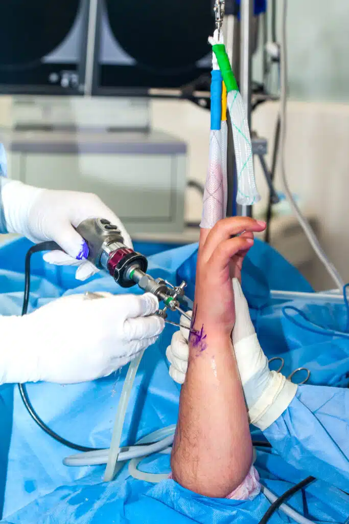 Group of orthopedic surgeons performing a wrist arthroscopy on a male patient