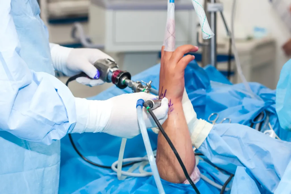 Arthroscopie du poignet au bloc, main suspendue en traction, chirurgien ganté