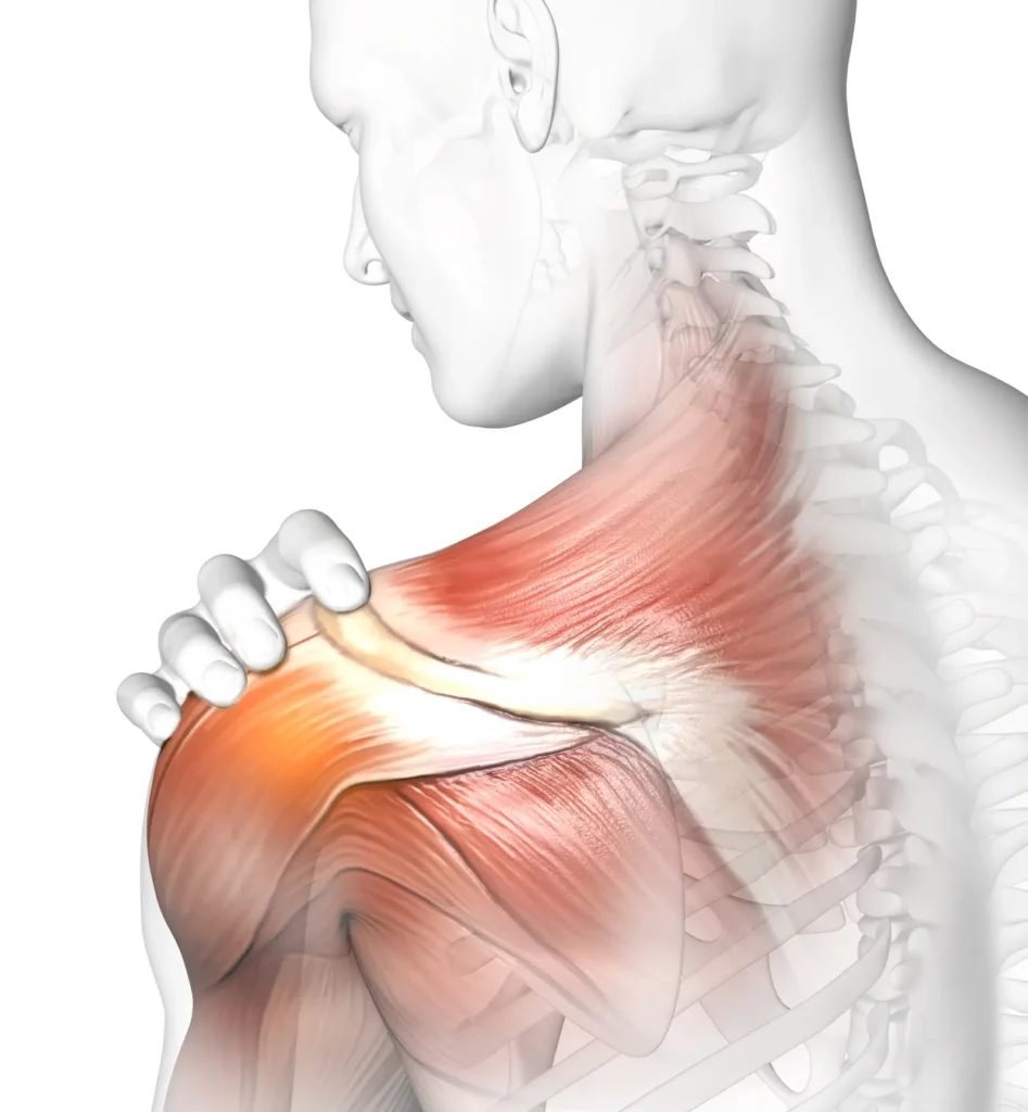Illustration anatomique de l'épaule et de la nuque, muscles en rouge, main posée sur l'épaule